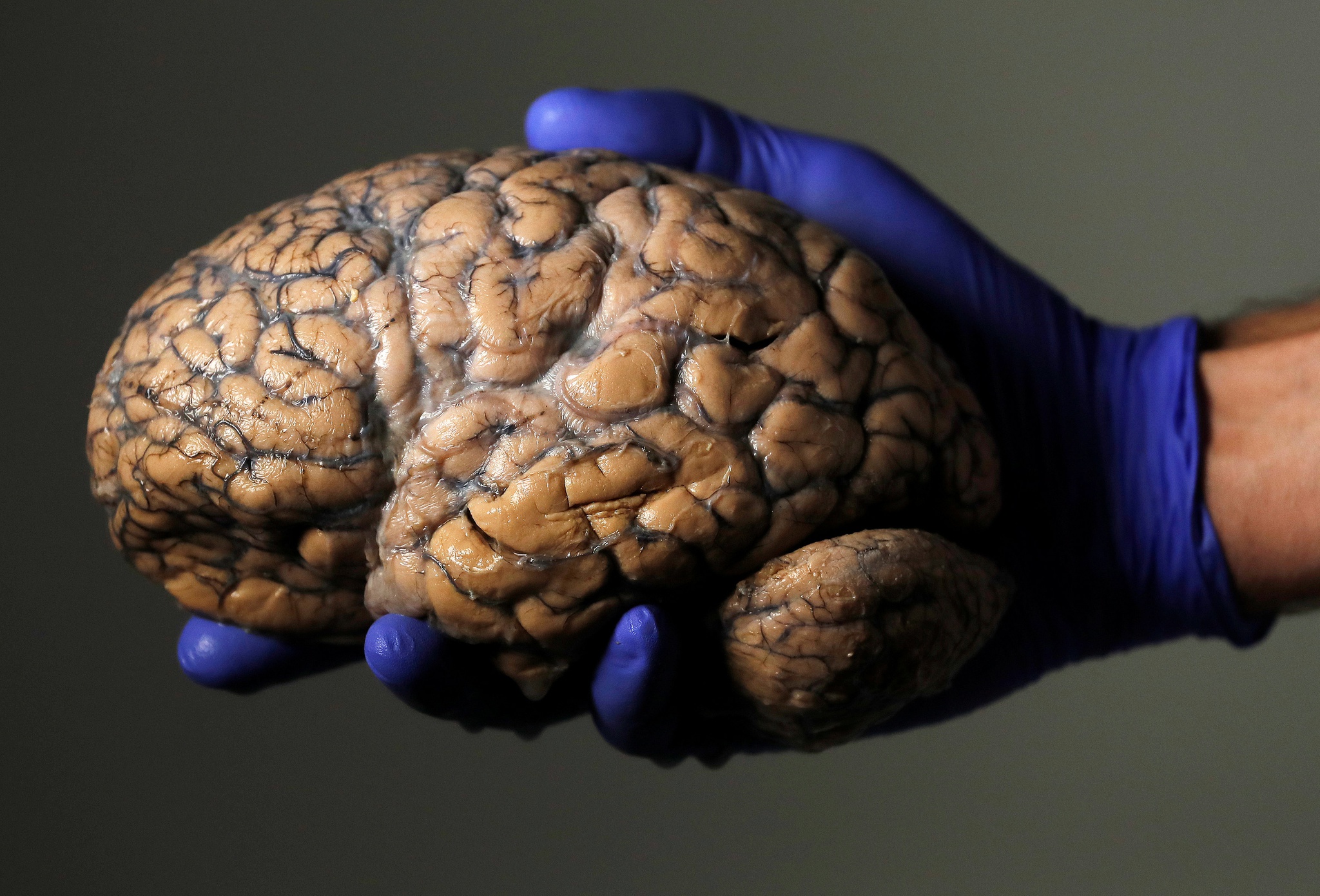 Diferença entre o cérebro humano e outras espécies